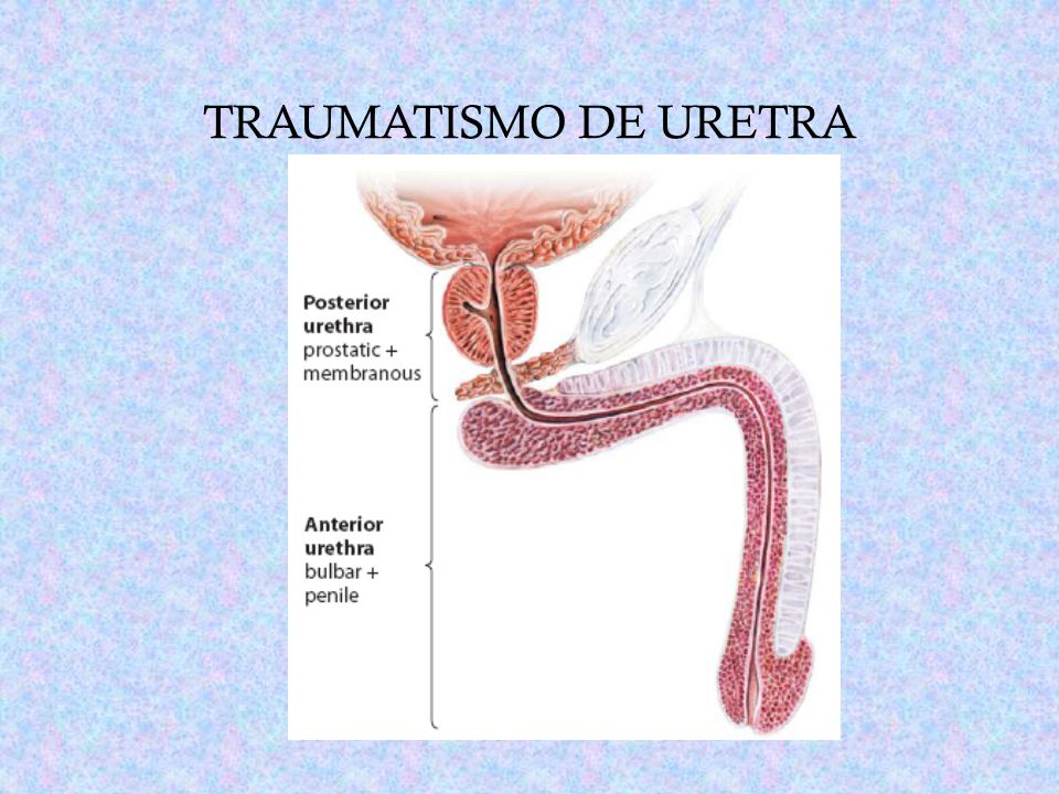 trauma uretra masculina trauma uretra masculina
